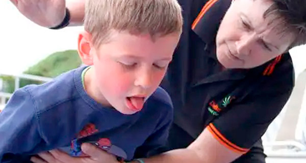 Desfi Depot - Paro Cardiorrespiratorio por Atragantamiento