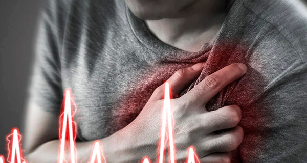 Desfi Depot - ¿Infarto o Paro?