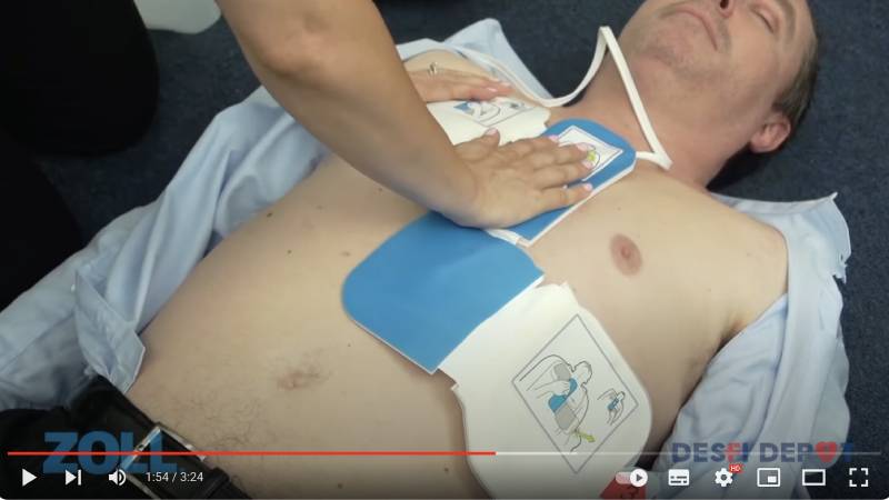 DESFI DEPOT Colocación de los parches CPR-D Padz de Zoll